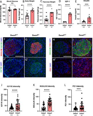 Decreased IGF1R attenuates senescence and improves function in pancreatic β-cells